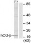 CGB / hCG Beta Antibody (aa101-150)